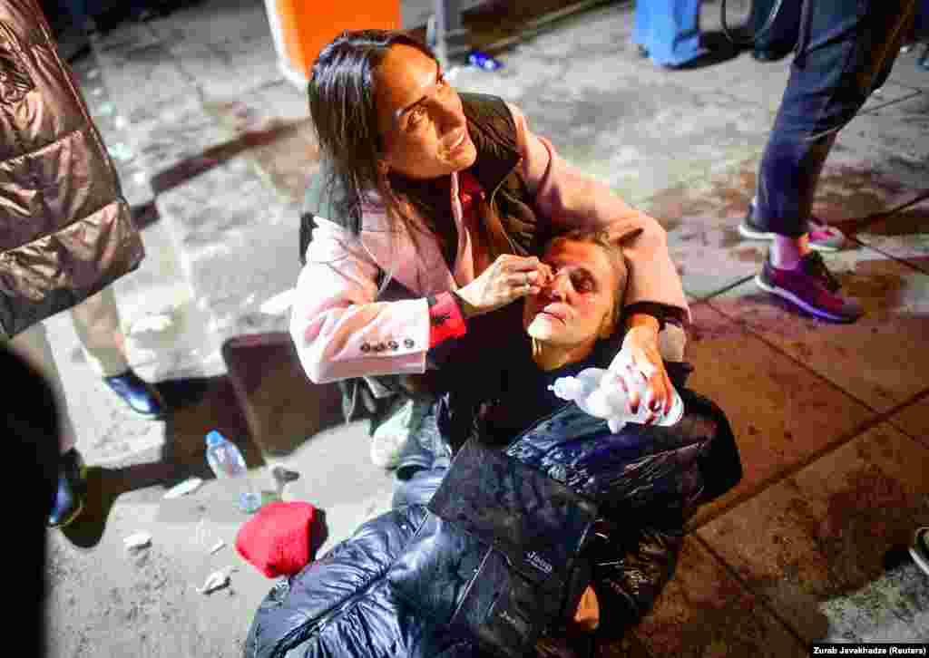 O femeie afectată de gazele lacrimogene primește ajutor în timpul protestului. Președinta georgiană Salome Zurabișvili i-a aplaudat pe protestatari în timp ce se afla într-o vizită în Statele Unite. „Voi reprezentați o Georgie liberă, o Georgie care își vede viitorul în Occident și care nu va lăsa pe nimeni să îi ia acest viitor", a spus ea într-un discurs video.