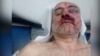 Давид Кацарава в больнице