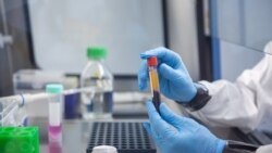 Virológiai vizsgálati minták a PTE Szentágothai János Kutatóközpontjának laboratóriumában 2023. február 7-én (képünk illusztráció)