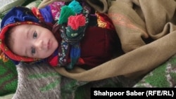 یک کودک مبتلا به سوء تغذیه در شفاخانه بادغیس