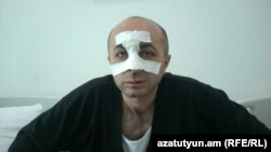 Айк Ханумян в больнице Степанакерта, 7 июля 2016 г․