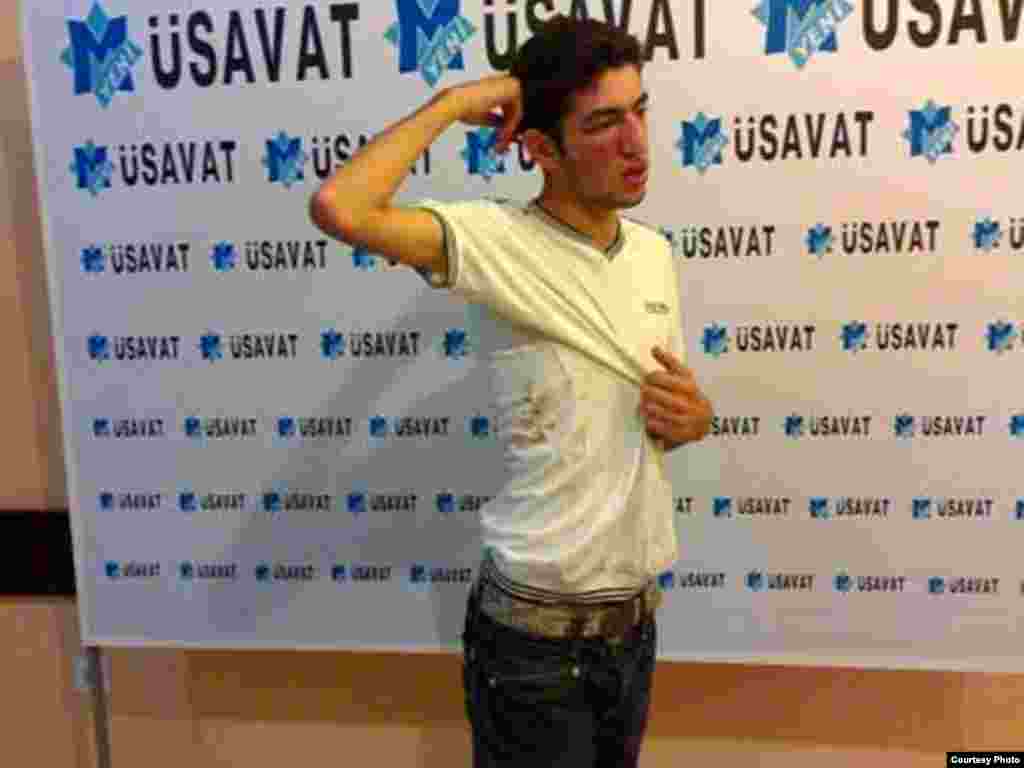 Emin Bədəlov, "Yeni Musavat" qəzetinin əməkdaşı. 2010-cu il iyulun 29-da döyülüb. 