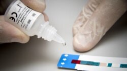 «ՄԻԱՎ վարակով կնոջը ԷԿՈ չեն արել». կնոջ խոսքով՝ հենց բժշկի կողմից է թիրախավորման ենթարկվել