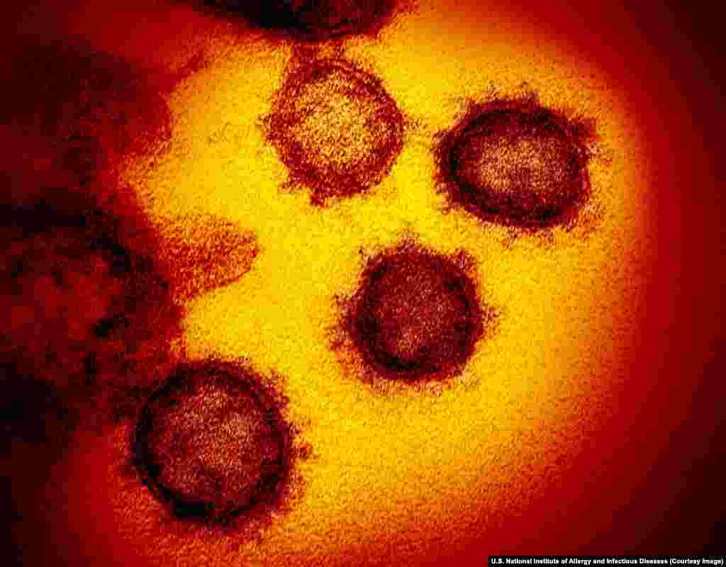 Ciorchini de virioni (așa se numește întreaga particulă a virusului în stare naturală) de SARS-CoV-2 (sindrom sever acut respiratoriu coronavirus 2) văzuți cu ajutorul microscopului electronic. Noul coronavirus a fost identificat pentru prima dată în orașul Wuhan, China, cândva, către finalul lui 2019 și a ucis mai mult de 36 de mii de oameni în întreaga lume până pe 30 martie. 