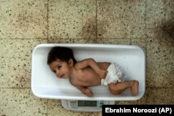 Një foshnjë e kequshqyer peshohet në një spital në Kabul, Afganistan (Fotografi nga arkivi).
