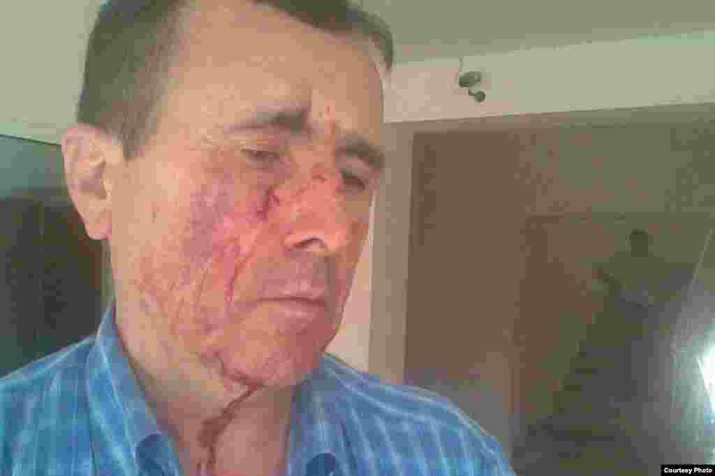 Məhbub Zülfüqarlı, jurnalist, 2011-ci il iyulun 7-də döyülüb. 
