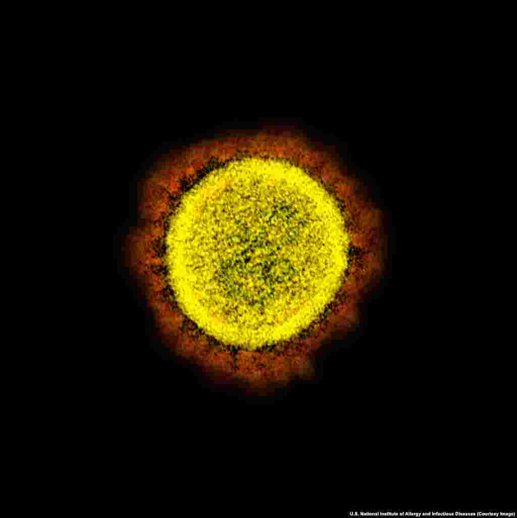 Un virion de SARS-CoV-2 Coronavirusurile sunt numite „corona” din pricina faptului că, văzute la microscop, au în jurul lor un halo sau o coroană, adică, în limba latină, „corona”.