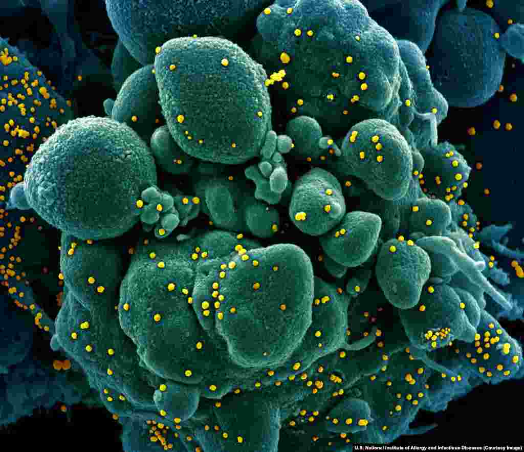 Virioni de SARS-CoV-2 punctând suprafața unei celule umane. Coronavirusurile sunt o familie de patogeni care include virusurile mortale ale SARS și MERS, dar și alte tipuri relativ inofensive de virus.