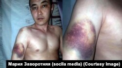 Эмилбек Кимсановдун абакта сабалганы тууралуу адвокаты тараткан сүрөтү. Апрель, 2020-жыл.
